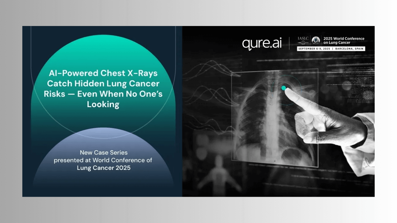 AI chest X-rays find hidden lung cancer early, ease radiology strain